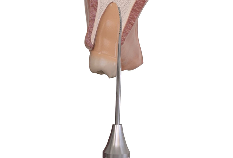 Comfort NiTi PerioSaw